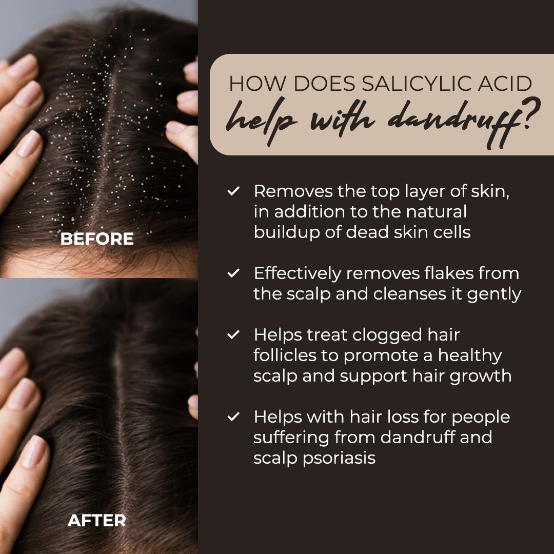 VITANATURE+ Kalin Scalp Treatment Conditioner 200ml