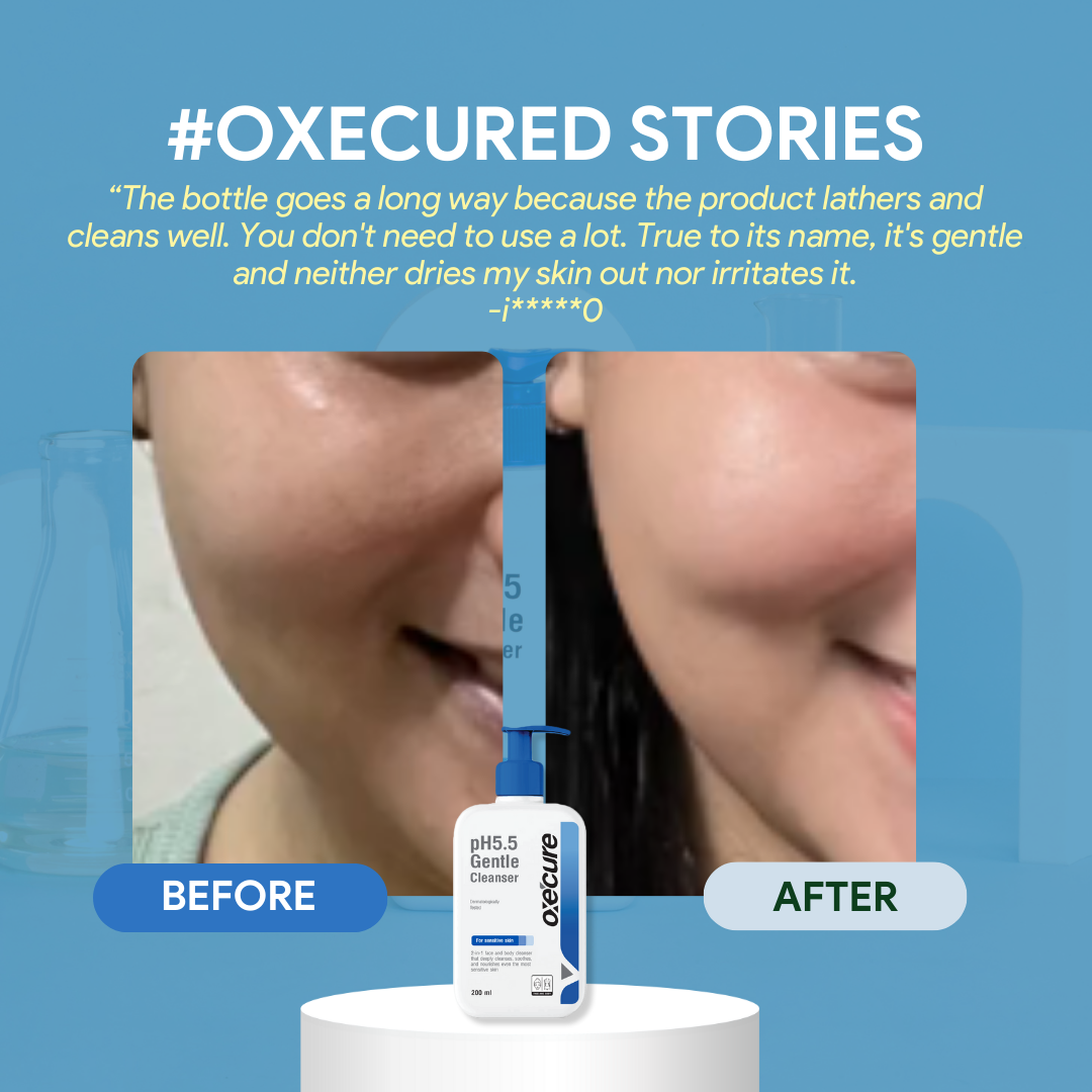 OXECURE pH 5.5 Gentle Cleanser 200ml