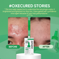 OXECURE Acne Defense Prebio Serum 5ml