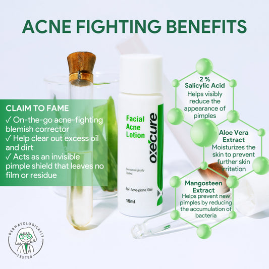 OXECURE Facial Acne Lotion 10ml (STICKERED) (Expiring Aug 2025)